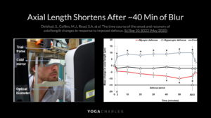 Axial Length Shortens